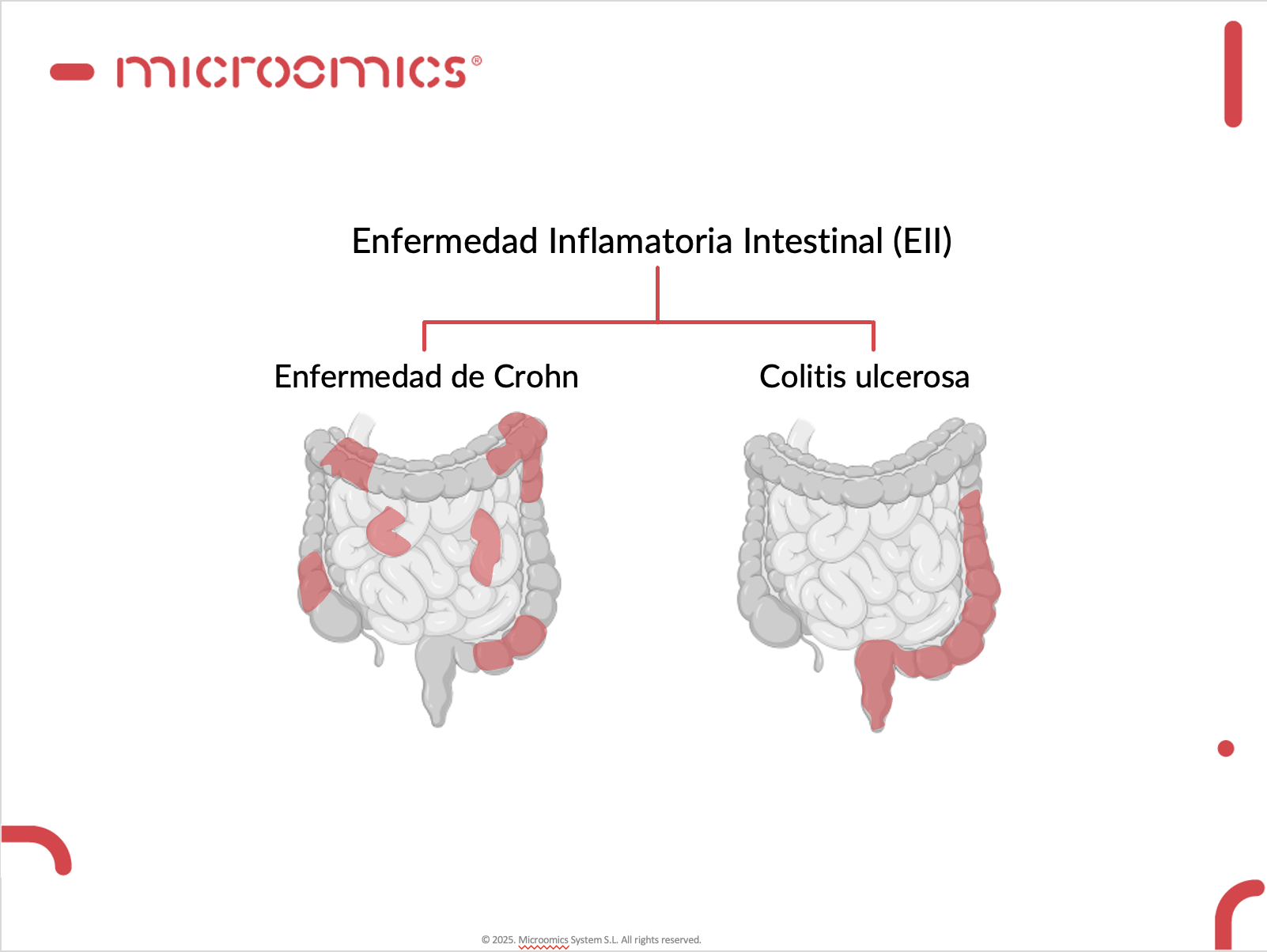 19 mayo Día Mundial de la Enfermedad Inflamatoria Intestinal (EII)