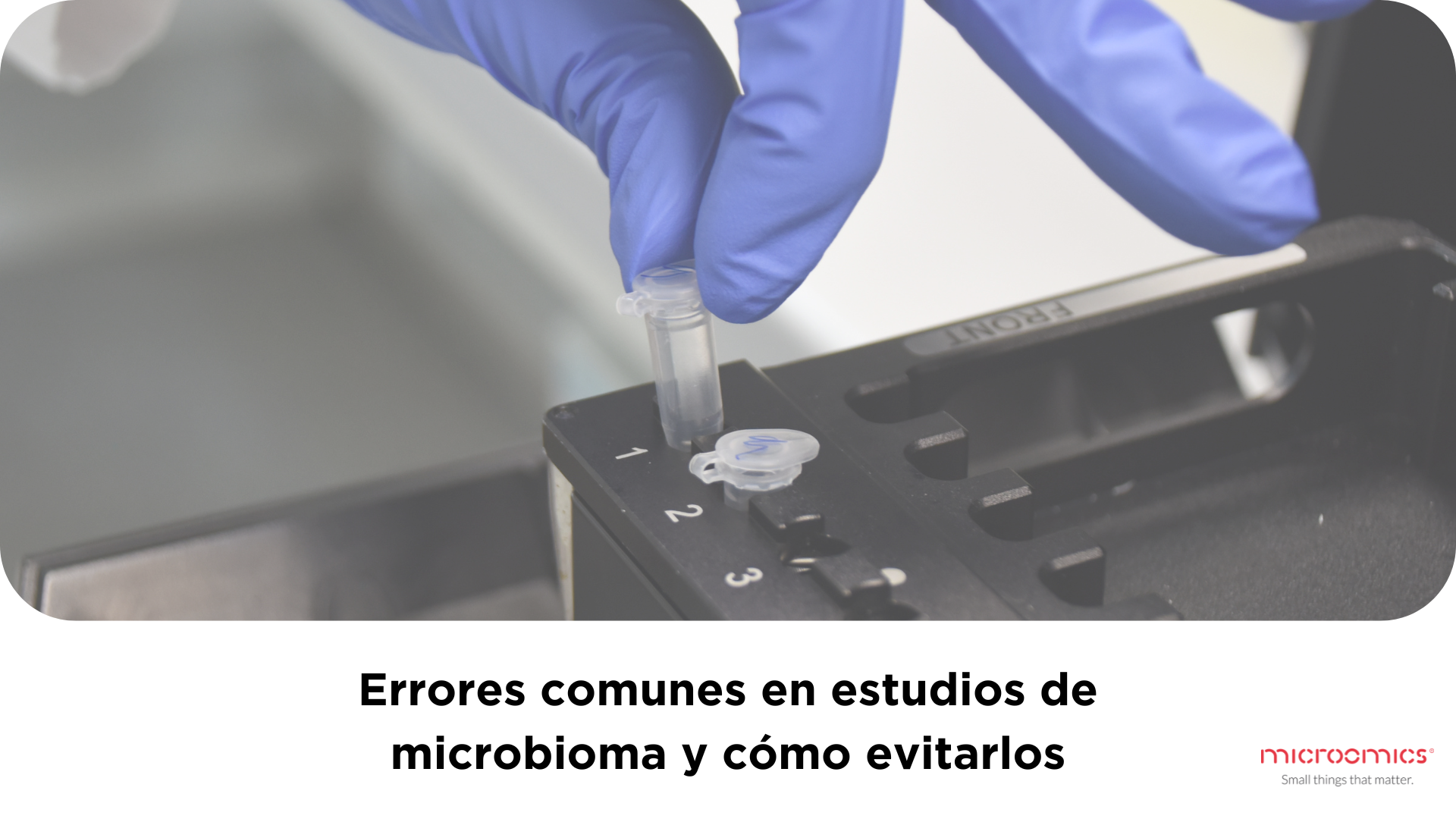 Errores comunes en estudios de microbioma y cómo evitarlos