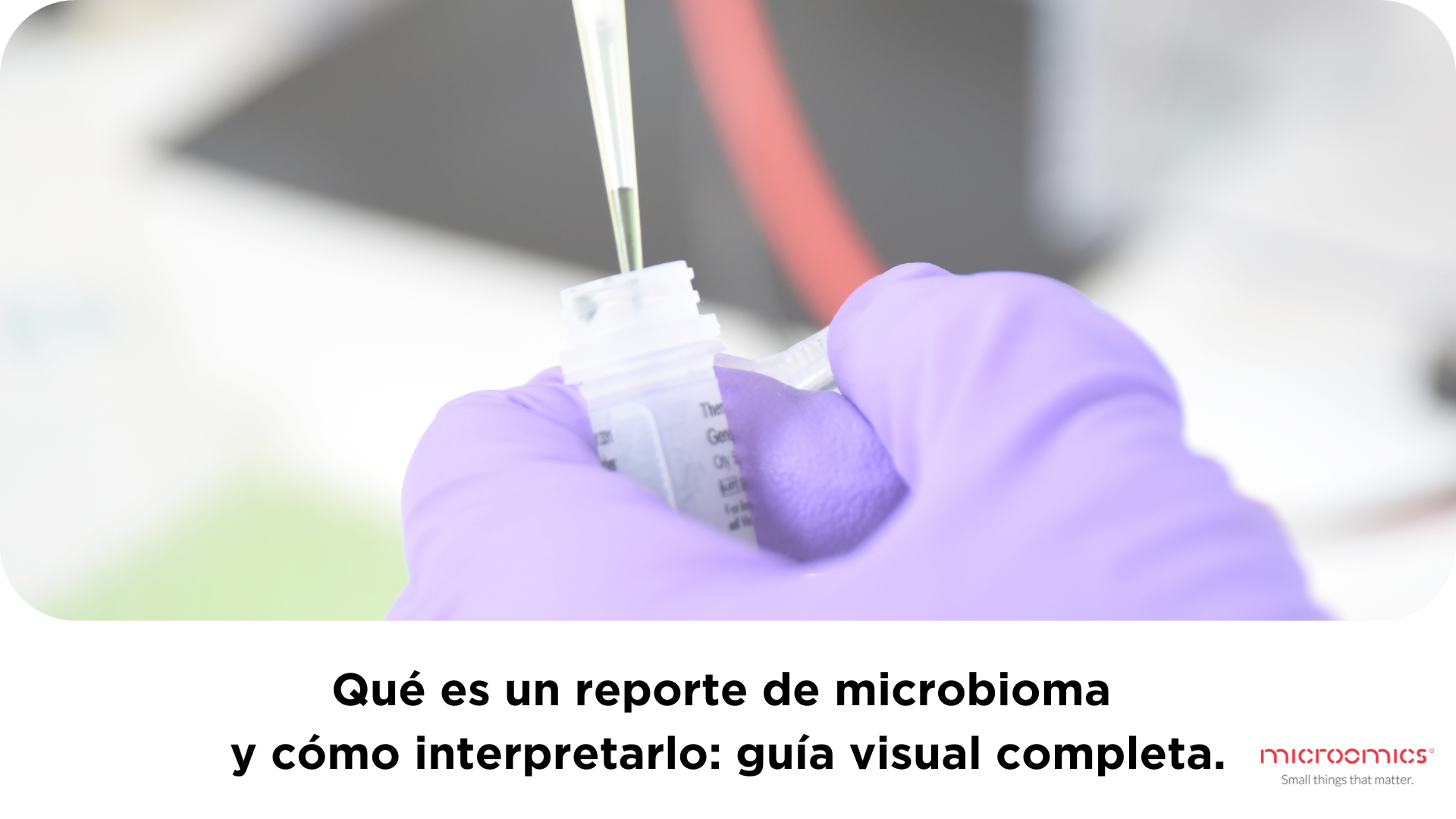 Qué es un reporte de microbioma y cómo interpretarlo.